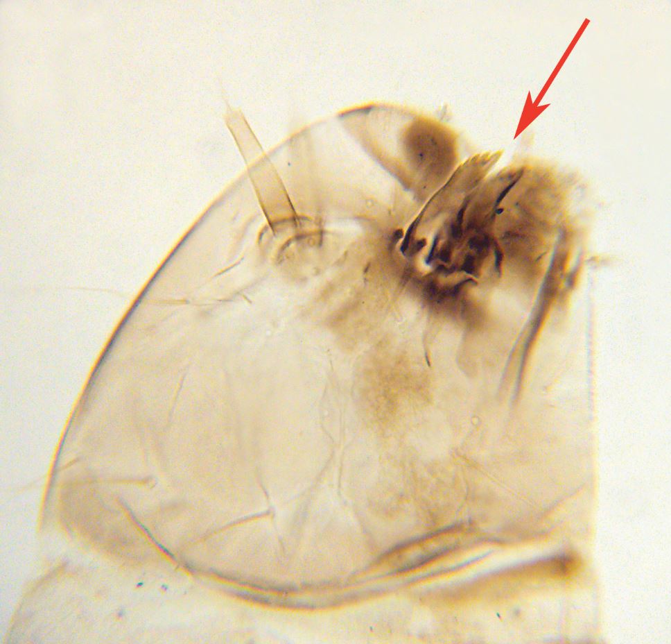 Microscope preparation of flea larva showing mandibles Credit Peter Barnard